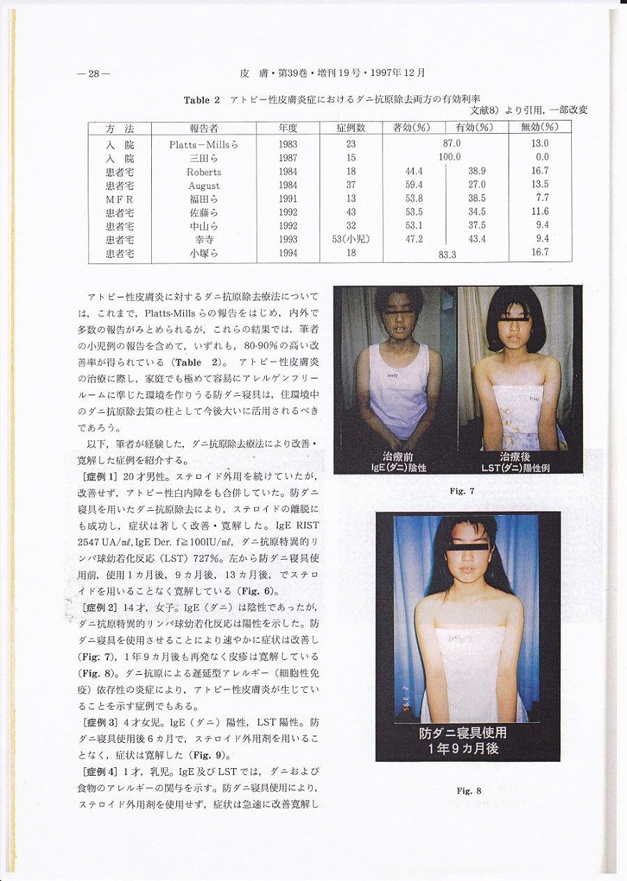 hifu5