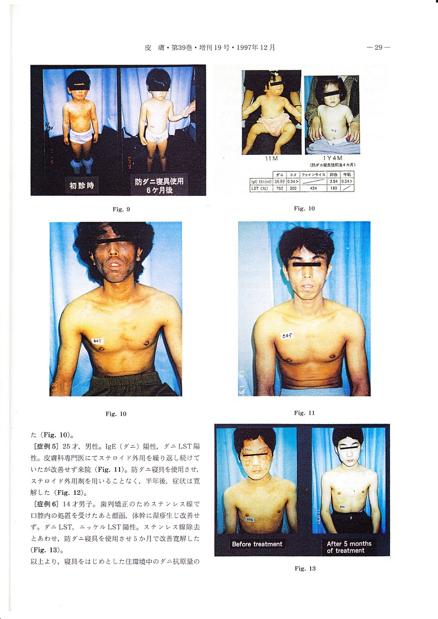 hifu6