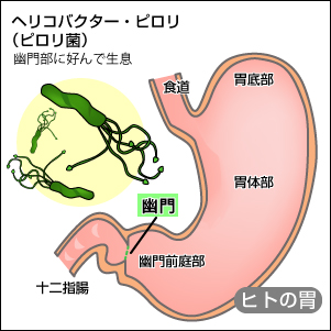 胃・幽門に生息するピロリ菌