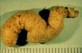 copidosoma3