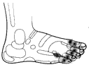 足裏刺激2