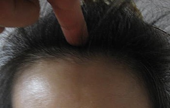 鼻づまりのツボ3