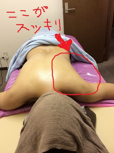 ビフォアアフター