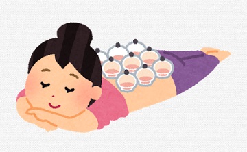 のカッピング(吸い玉)