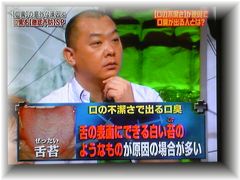 口臭の原因は舌苔!?