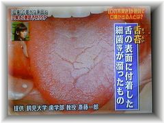 舌苔の写真画像