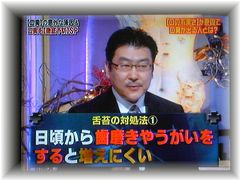 舌苔の対処法 舌苔対策
