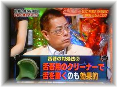 舌苔の対処法 舌苔対策