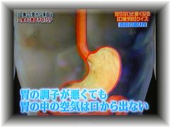 口臭は胃臭ではないという理由