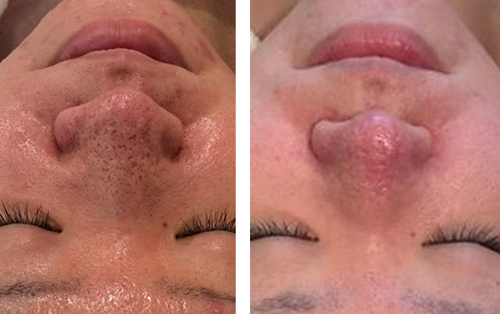 14年11月25日の記事 素肌新館ブログ