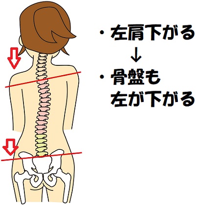 骨盤の歪みチェック 自分でできる整体