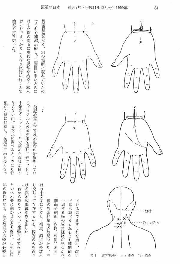 まき5