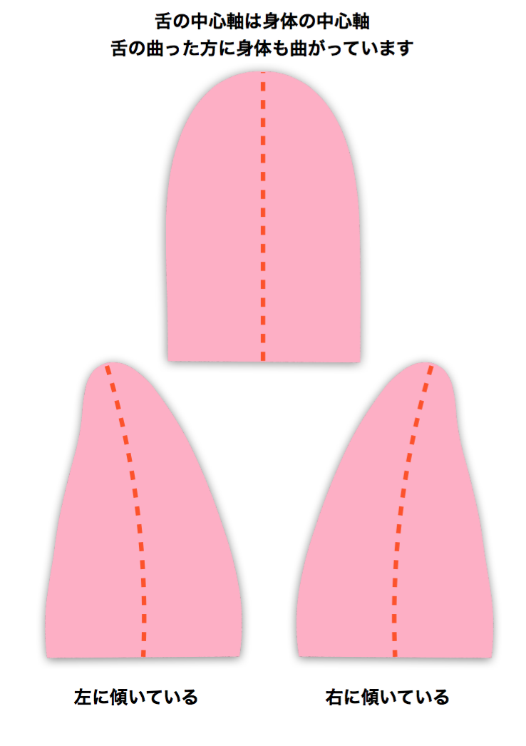 舌1