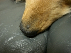 お鼻のおでき