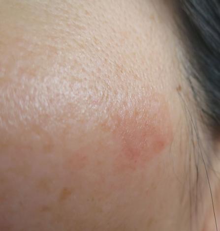 １カ月で顔のシミが消えるか 実践レポート 汚部屋お片付けブログ