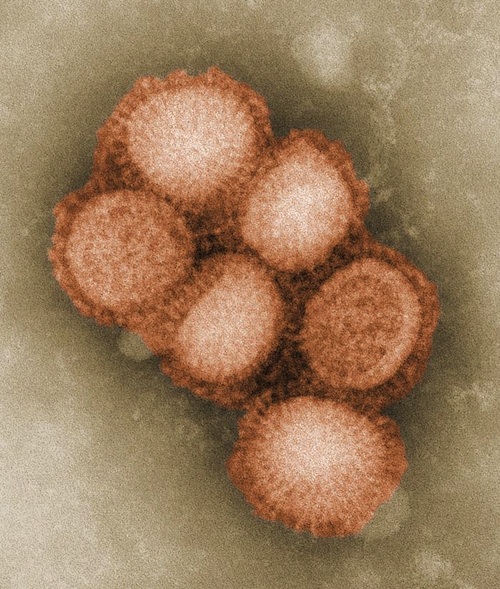 A_H1N1pdm09.jpg