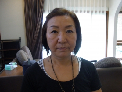 H様ビフォー