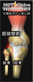 ¹øÄË¡¦¹üÈפΤ椬¤ß¡¦¸ª¤³¤ê¤Î¥±¥¢HOT ChiroÅÄÄ®_ɨ¤ÎÄˤß
