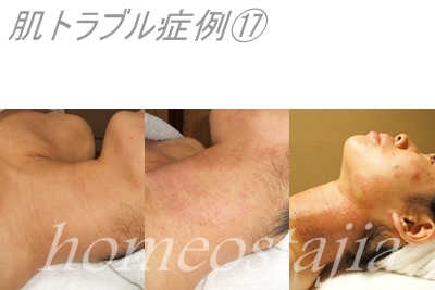 ステ?