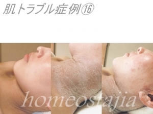 ステ?