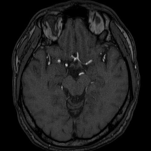 MRI2