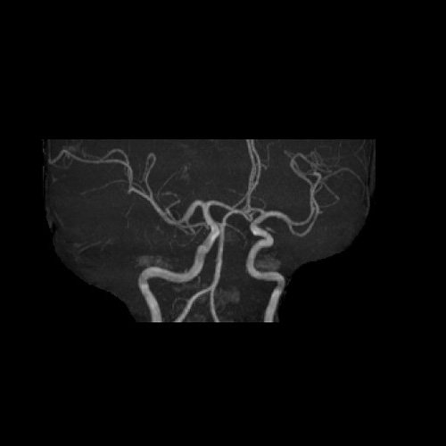 MRI3
