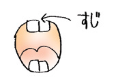 歯のすじ