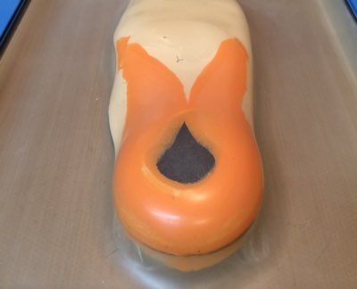 バキューム