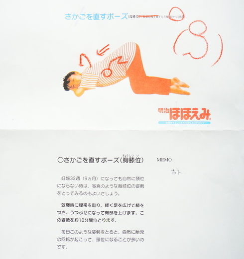逆子体操【さかごを直すポーズ(胸膝位】
