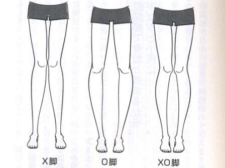 脚のライン(X脚 O脚 XO脚)