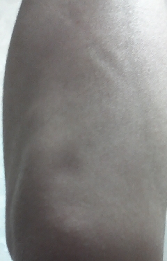 20131223