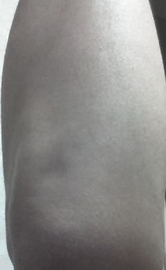 20131228