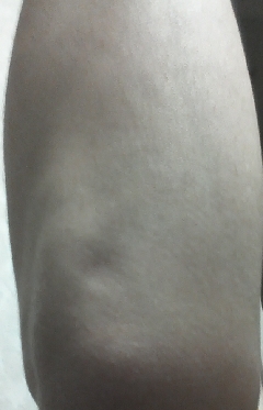 20131231