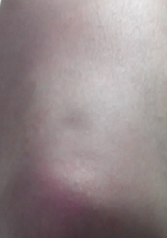 20141221