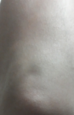 20141222