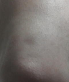 20141228