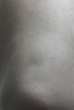 20141231