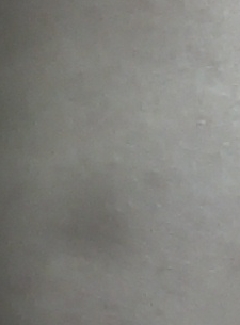 20151231