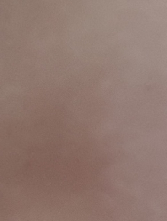20170725