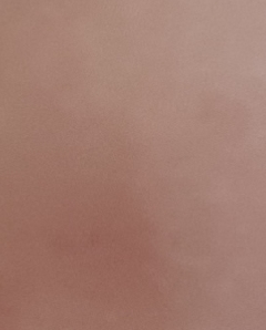 20180318