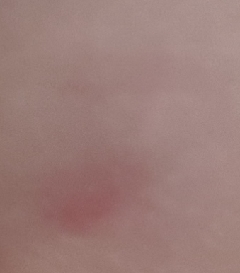 20180711