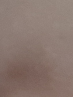20180914