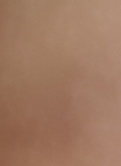 20181204