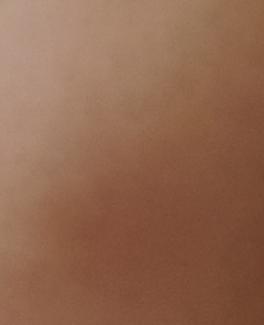 20181224