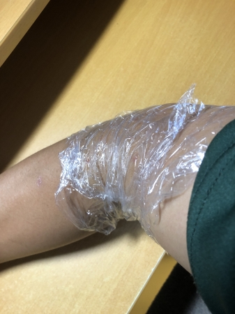 薬塗った