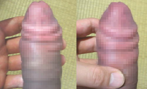 ペニスの黒さ比較画像