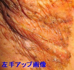 左アップ