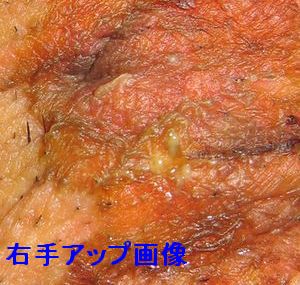 右ワキアップ