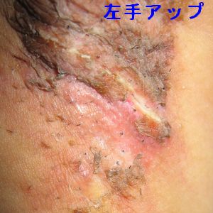 左アップ