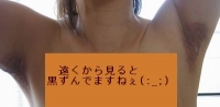 両脇